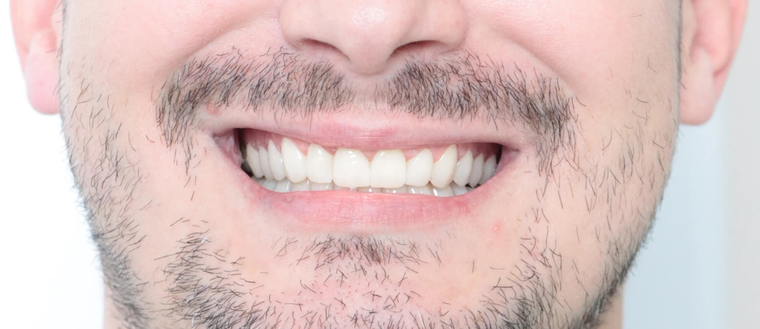 After treatment