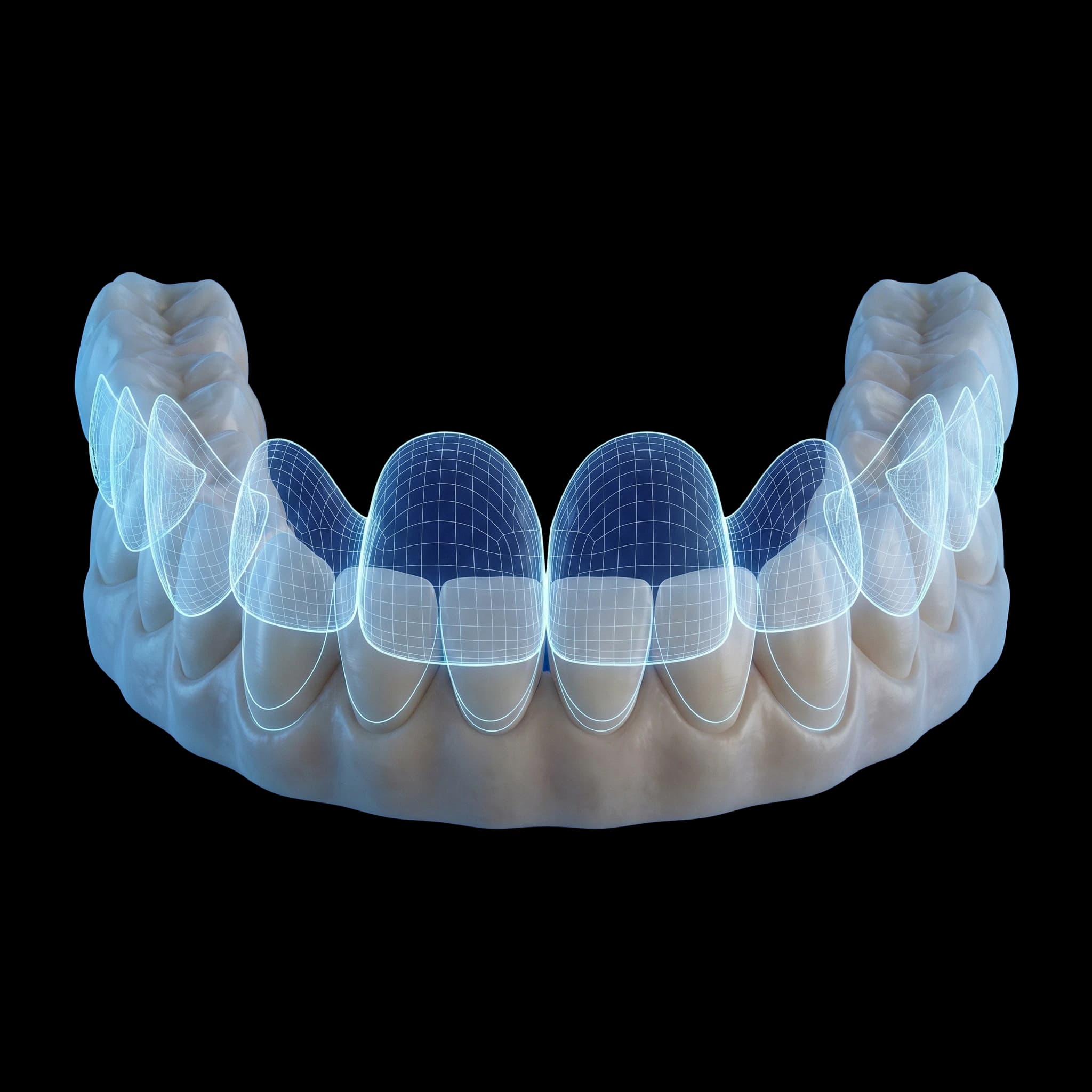 Digital Smile Design