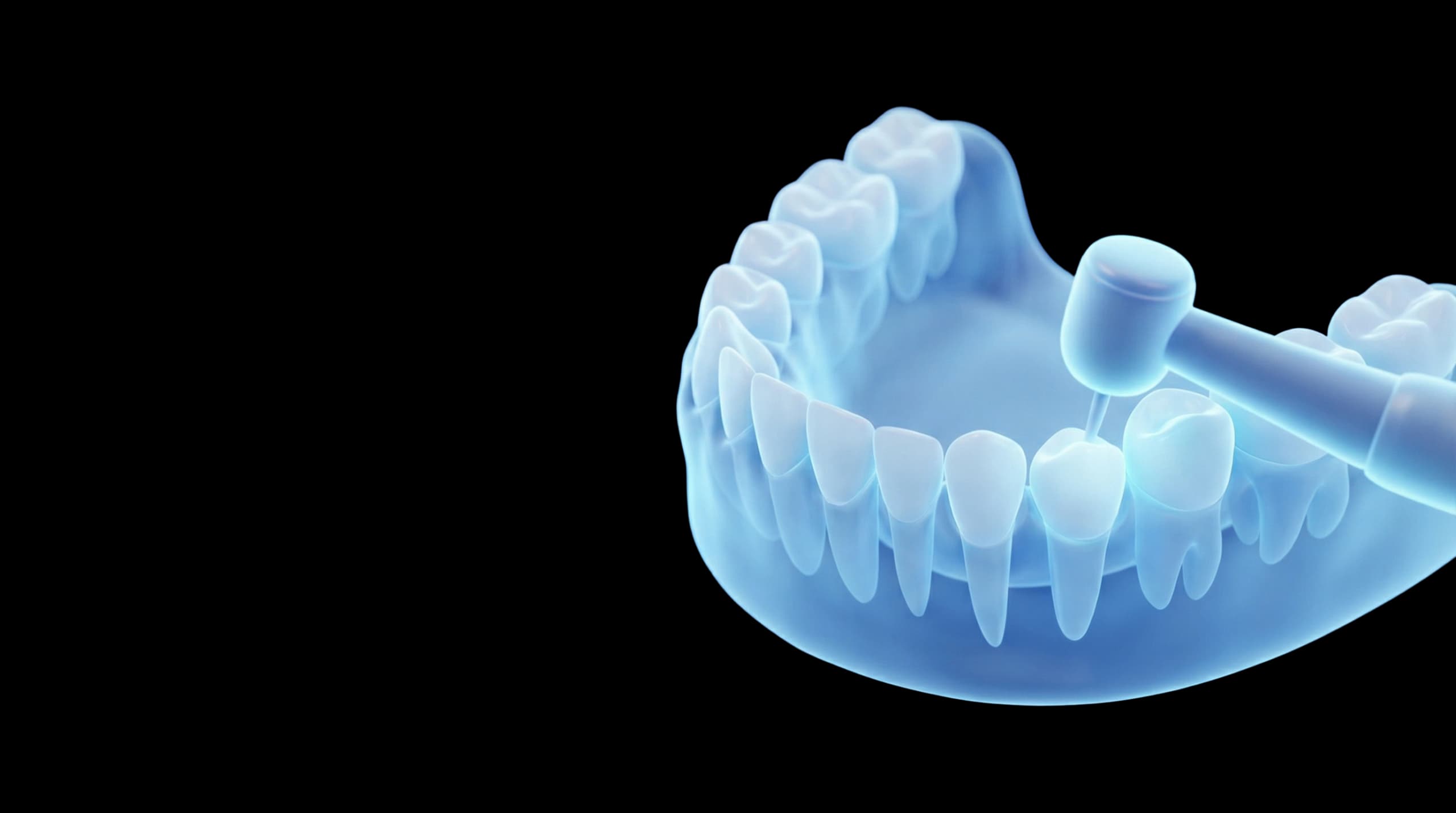 Pediatric Dental Care