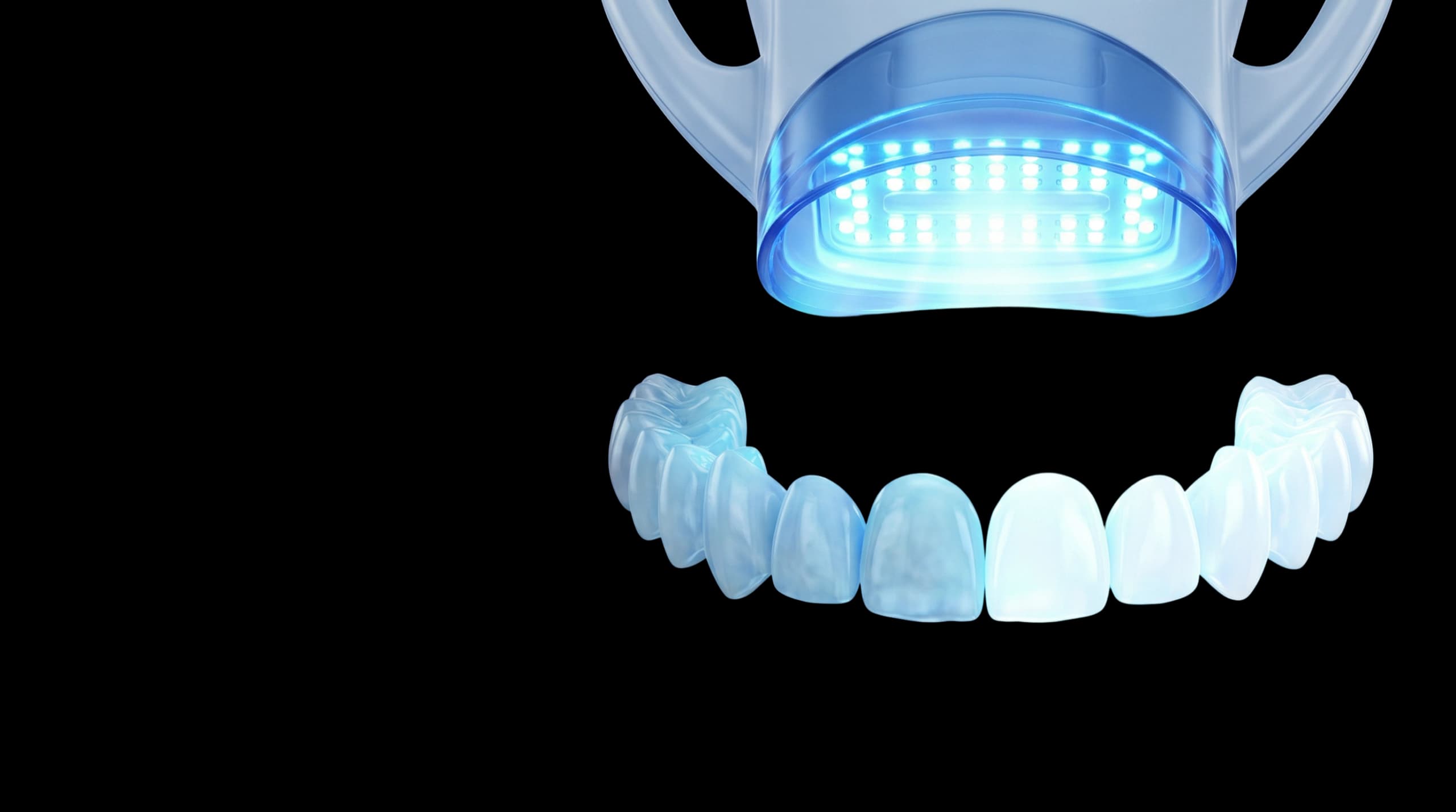 Teeth Whitening